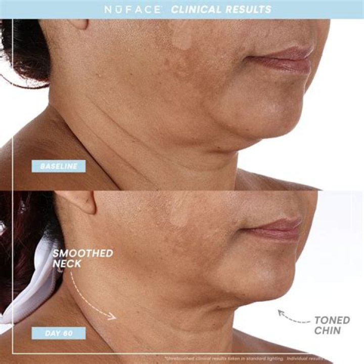 nuface reviews